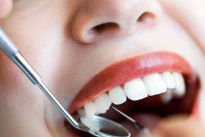 Top 8 Tips To Protect Your Teeth